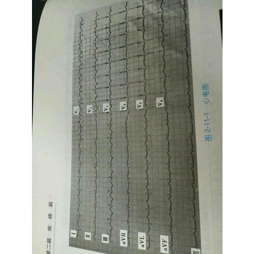 內科學(心血管內科分冊）