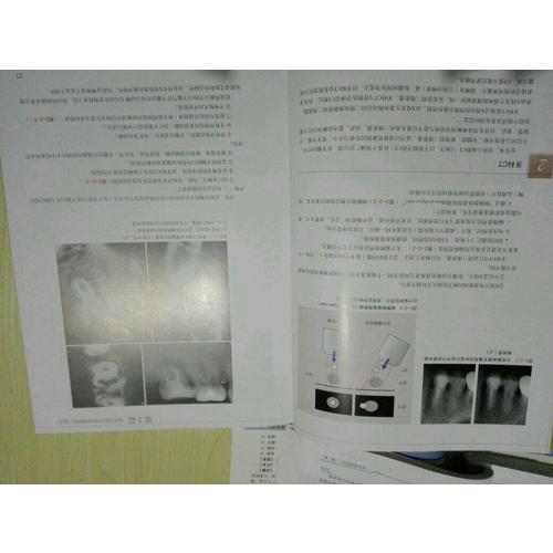 牙髓根尖周病病例分析與臨床實戰