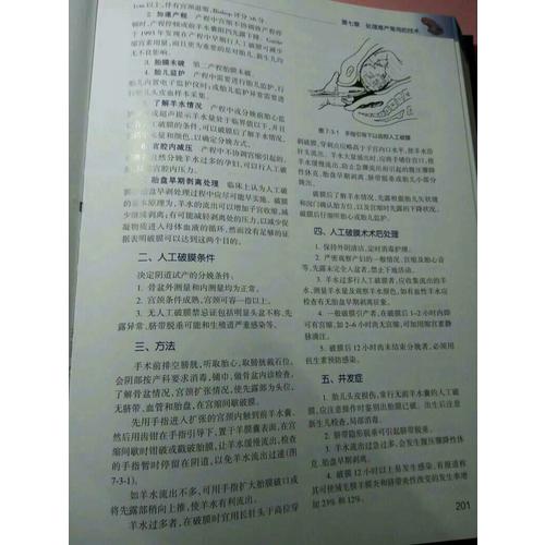 難產(配增值)