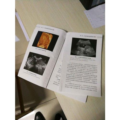 中國婦科超聲檢查指南