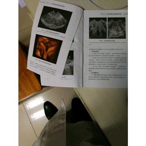 中國婦科超聲檢查指南