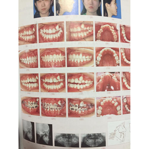 實用正畸弓絲彎制技術圖譜