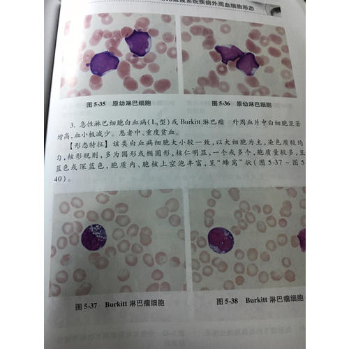 血象·外周血細(xì)胞圖譜