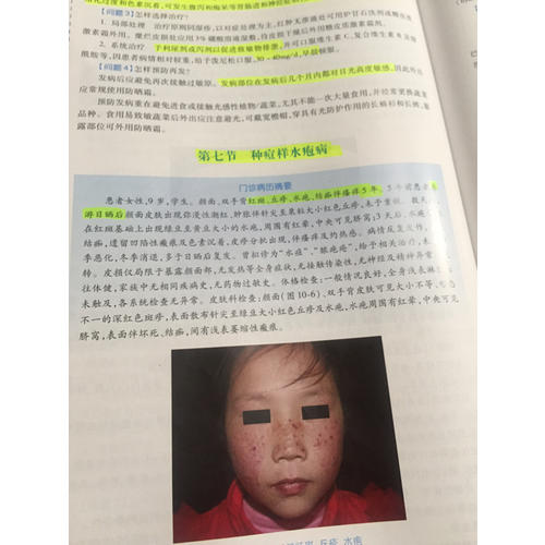 國家衛生和計劃生育委員會住院醫師規范化培訓規劃教材·皮膚性病學