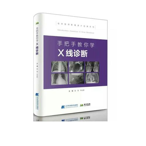 手把手教你學(xué)X線診斷