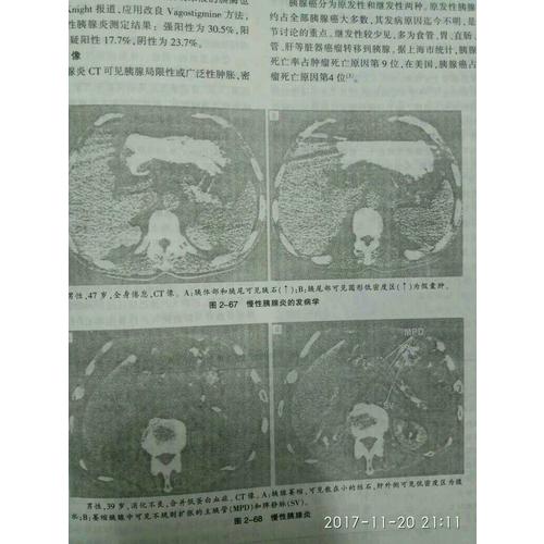 現(xiàn)代代謝與營養(yǎng)性疾病