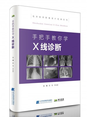手把手教你學(xué)X線診斷
