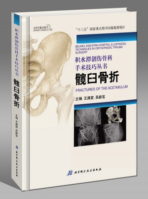積水潭創(chuàng)傷骨科手術(shù)技巧：髖臼骨折