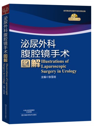 泌尿外科腹腔鏡手術(shù)圖解