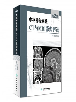 中樞神經(jīng)系統(tǒng)CT和MRI影像解讀（第2版）