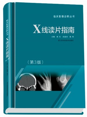 X線讀片指南 （三版）