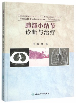 肺部小結節診斷與治療(精)